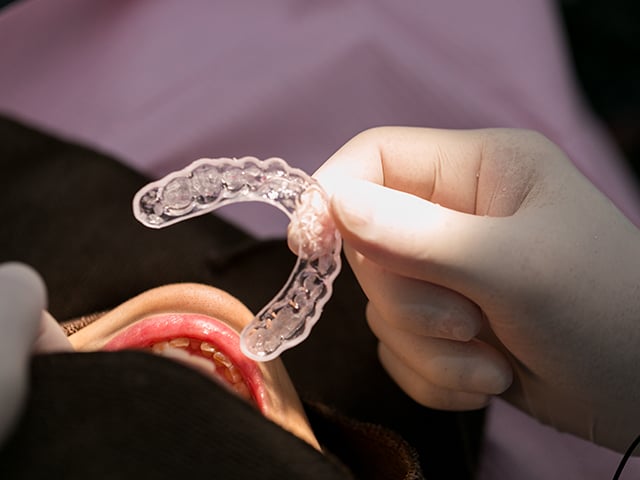 矯正歯科｜世田谷上町駅から徒歩0分の歯医者|すみとも歯科・矯正歯科