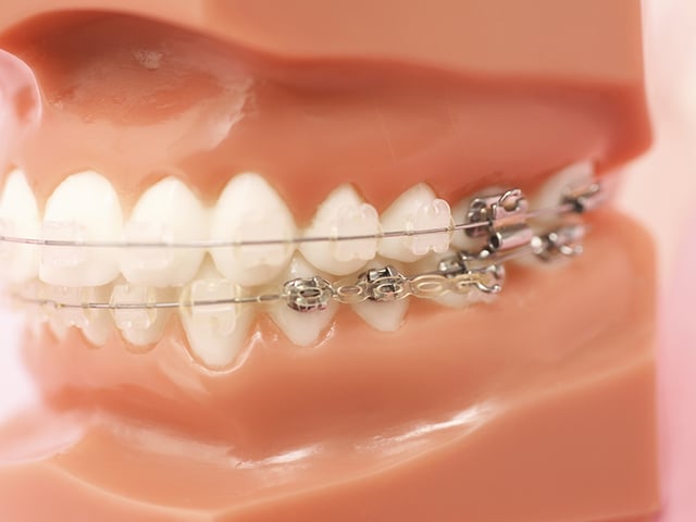 矯正歯科｜世田谷上町駅から徒歩0分の歯医者|すみとも歯科・矯正歯科